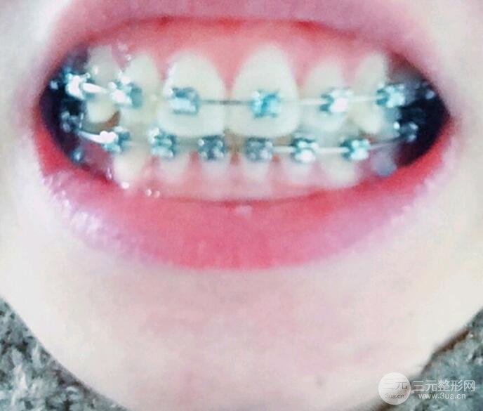 案例1