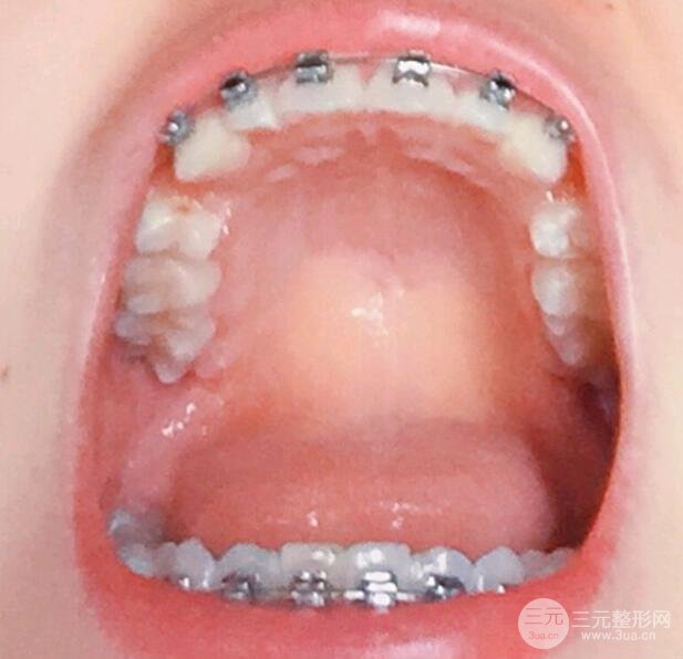 案例1