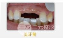 案例2