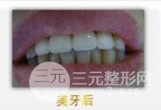 案例2