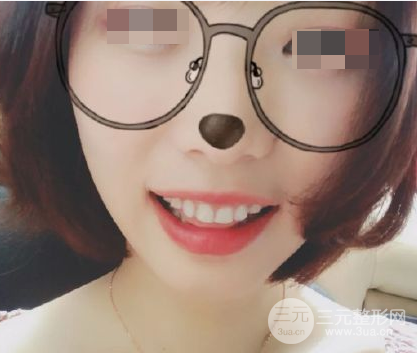 北京积水潭医院牙齿矫正案例