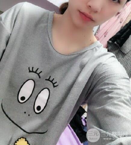 徐州中医院整形美容隆胸案例