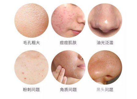嘉兴荣军医院皮肤科激光美容价格表