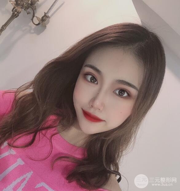 肋软骨隆鼻案例