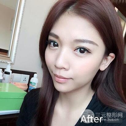 口碑评价
