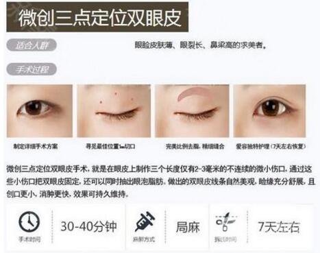 开展项目介绍