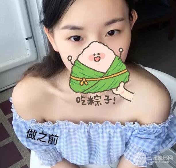 开展项目介绍