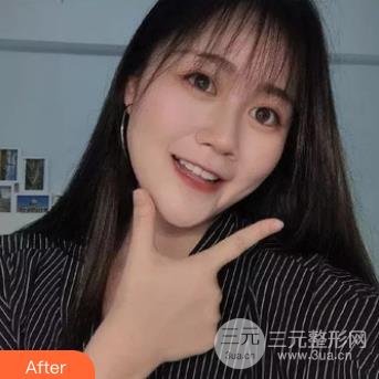 [在线获取]无锡人民医院美容点痣价格表，医生名单&案例~
