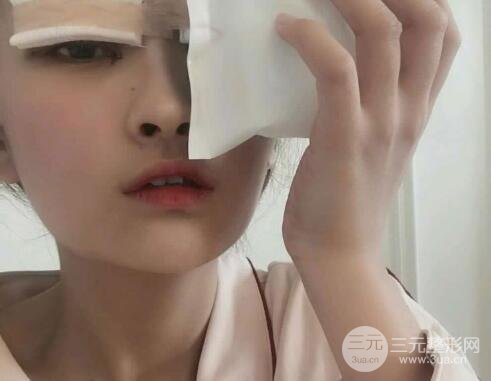 三点式双眼皮