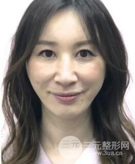 除皱对比图