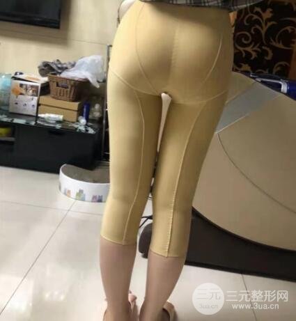 大腿吸脂