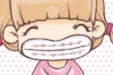 天包地牙齿矫正图片