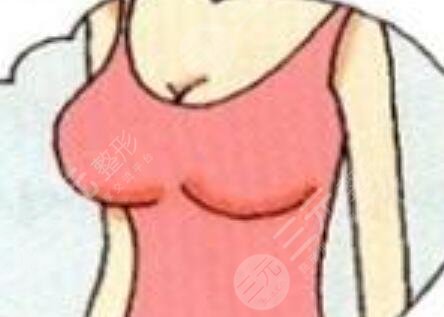 小姐姐丰胸前后对比真实照片