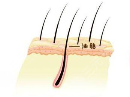 深圳北大医院陈办成植发案例