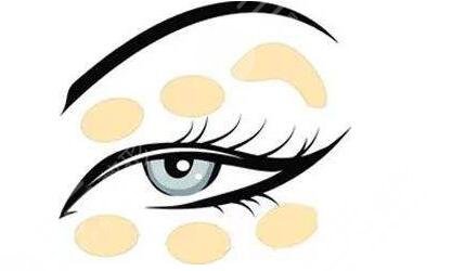 北京协和医院黄渭清双眼皮怎么样？案例图公开