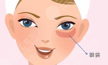 上海九院张亦医生去眼袋案例