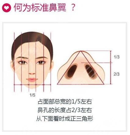 上海九院闵沛如隆鼻手术案例图