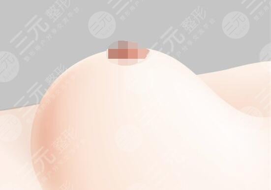 隆胸照片真人前后对比图来啦~从术前“飞机场”到术后的C杯女神逆袭之路~