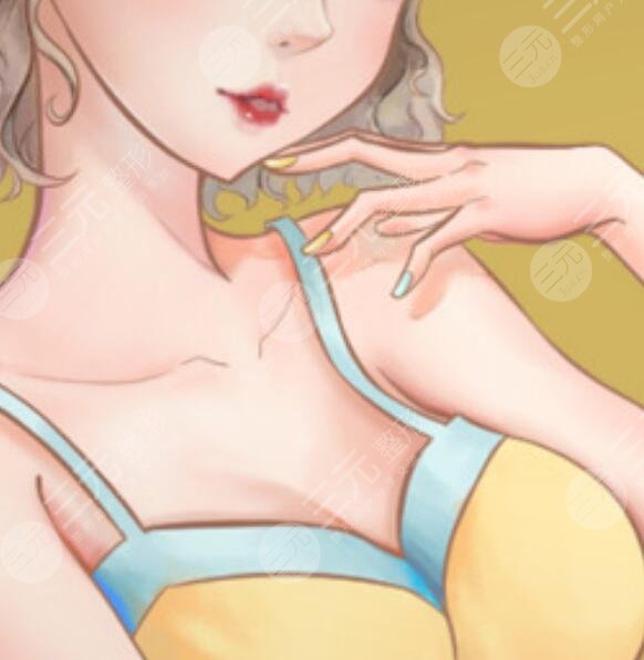 棉花糖假体隆胸术后半个月