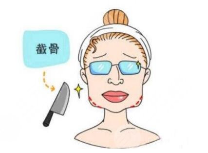 卢丙仑做过下颌角案例