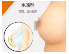 水滴型隆胸躺下后果