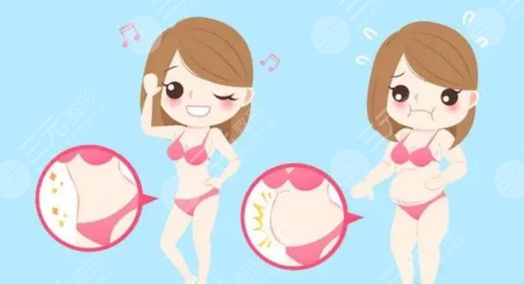 腰腹吸脂后1 到7天图片