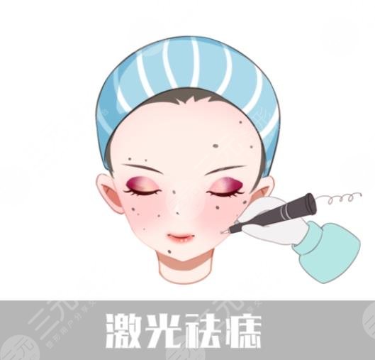 激光点痣是什么原理?激光点痣安全吗?