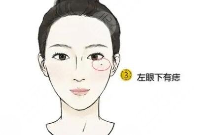 点痣过程