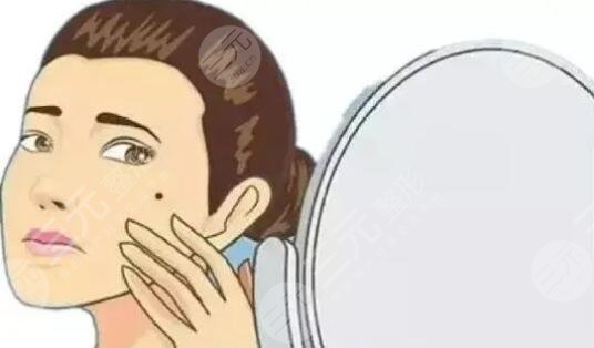 激光点痣的优势所在