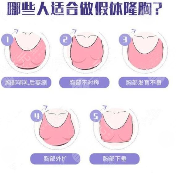 假体隆胸手术是不是安全的?
