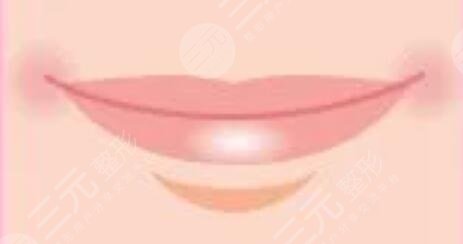 纹唇一到七天恢复图片