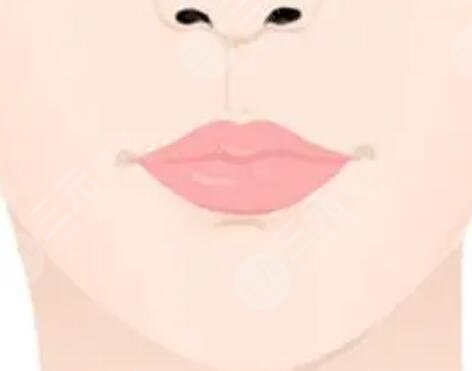 纹唇一到七天恢复图片