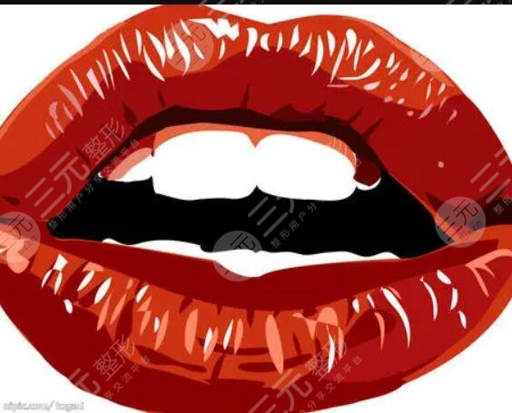 纹唇一到七天恢复图片