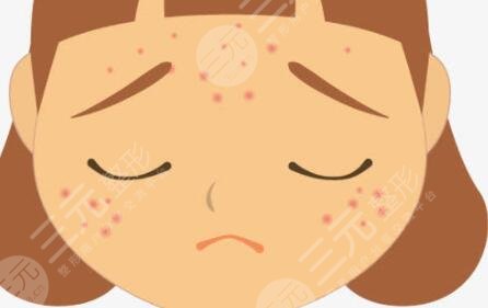 杭州三院激光美容科祛痘嫩肤果图~分享价格