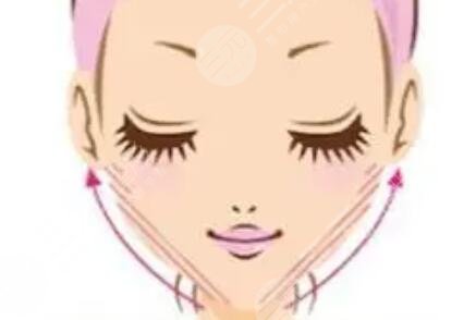 rd素注射瘦脸案例图