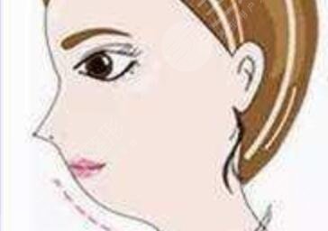 上海九院王涛隆鼻多少钱