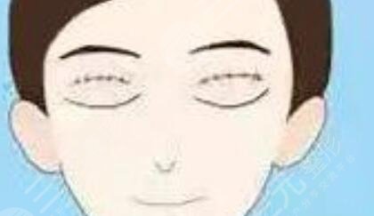 八大处何乐人做的双眼皮果图