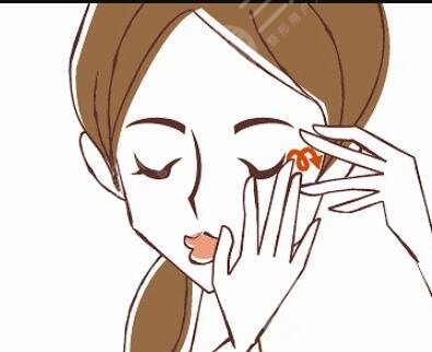 毕洪森内窥镜除皱案例 术后真的年轻好几岁了