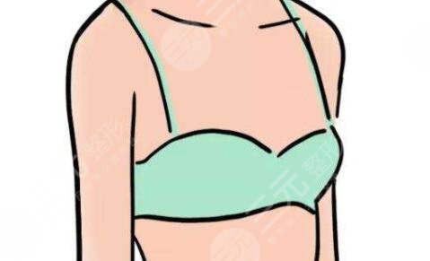 协和医院朱琳巨乳缩小手术案例，从此告别令人尴尬的大胸~