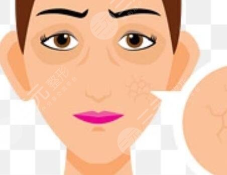 章庆国直埋再造耳图片赏析，附术后注意事项~