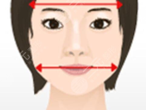 北京八大处归来做下颌骨价格表，附真实术后果图~