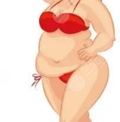 水动力吸脂瘦手臂前后果对比图和恢复过程