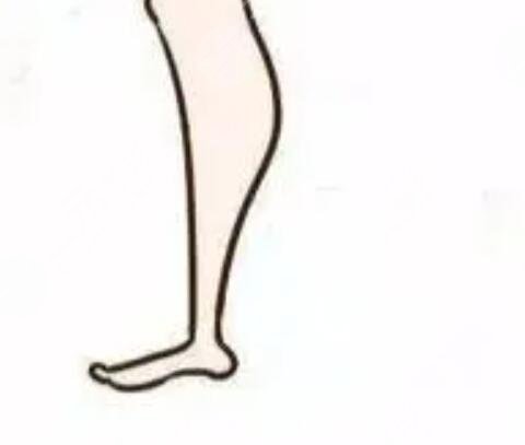 激光溶脂瘦腿术前后对比照还有恢复过程经历