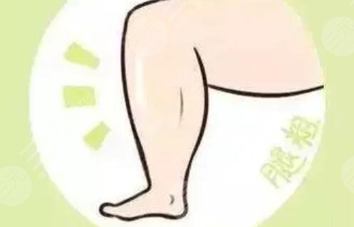 激光溶脂瘦腿术前后对比照还有恢复过程经历