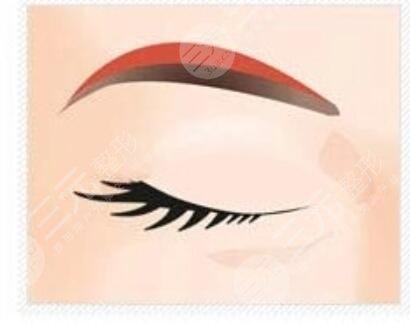 种眉毛好不好？自己种植眉毛恢复过程图分享