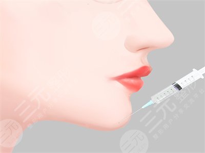徐州二院美容科张爱君假体丰下巴前后对比图 内有小彩蛋