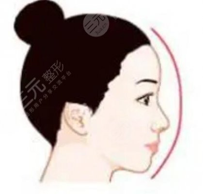 嘉兴艺星鼻部综合案例对比?内附医院价目表资料哦