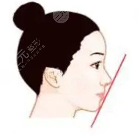嘉兴艺星鼻部综合案例对比?内附医院价目表资料哦