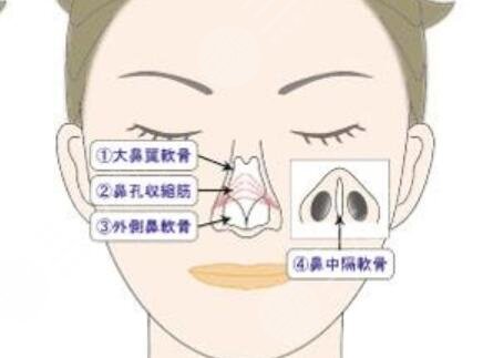 长春朗妍假体隆鼻前后恢复过程对比图