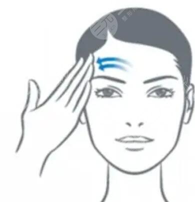 面部内窥镜去除抬头纹前后对比果图片和恢复过程